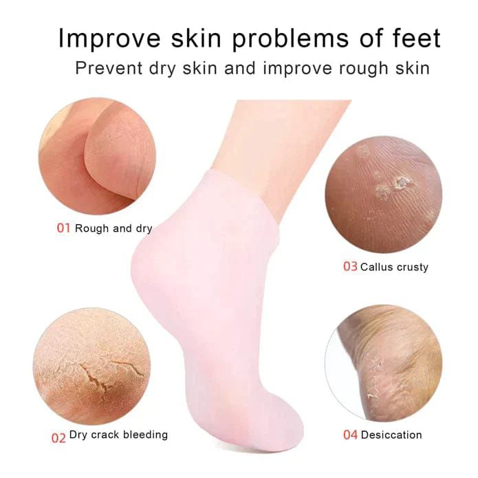 Moisturising Silicone Socks For Dry Cracked Heels